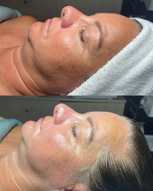 Sacred Skin Renewal Facial ($120)