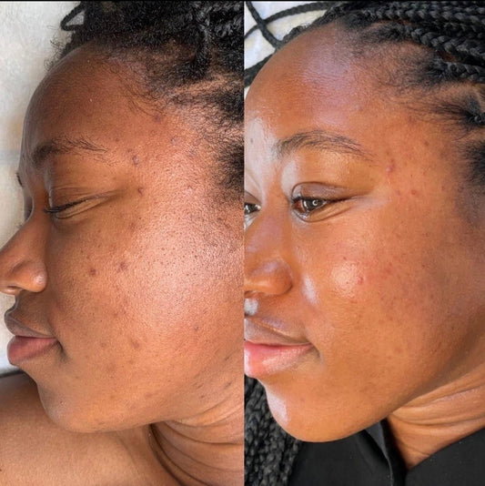 Seanergy Peel ($180)