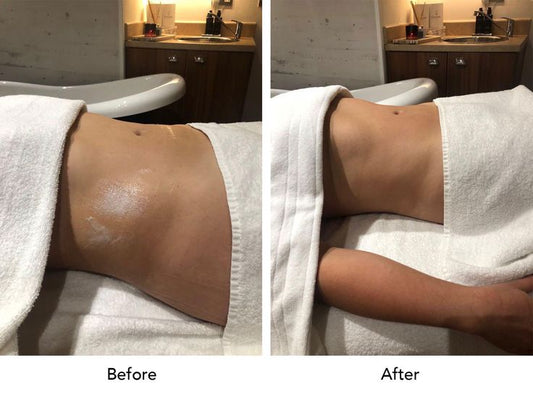 Brazilian Lymphatic Drainage (Detox & Sculpt Version) ($150)